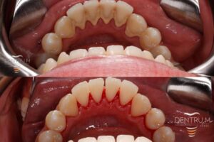 Skuteczne sposoby na usunięcie kamienia z prysznica, kabiny, wann i płytek